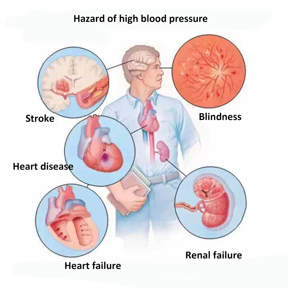 10 Vnt Kovos Su Hipertenzija, Gydymo Pleistras, Galvos Skausmas, Galvos Skausmo, Kinų Medicina Kontrolės Sumažinti Kraujo Spaudimą Medicinos Gipso