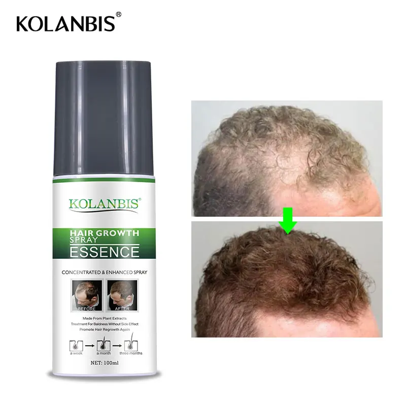 4pc riebiai augimo plikas purškimo tonikas ir ženšenio plaukų slinkimas atauga šampūnas skirtas vyrų alopecija greitai folikulus gydymo eteriniai aliejai