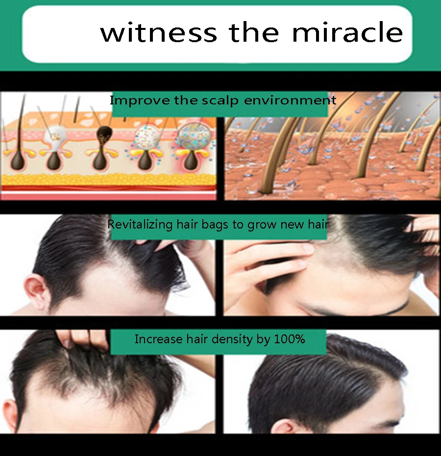 Greitai Plaukų Augimo Esmė Aliejus, Plaukų Slinkimas Gydymo Padėti plaukų Augimo Plaukų Priežiūra