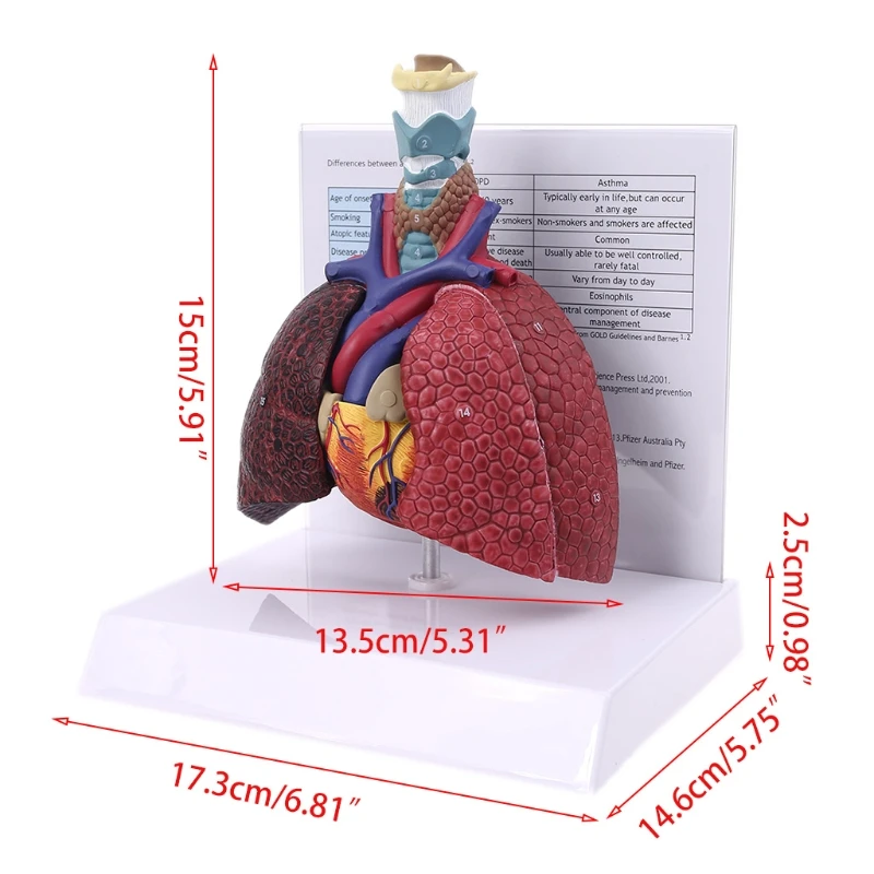 Gyvenimo Dydžio Žmogaus Plaučių Modelis Anatomijos Kvėpavimo Sistemos Anatomija Mokyklų Mokslo Ištekliai Tyrimų Ekranas Mokymo Priemonė